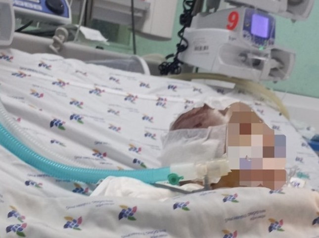 Bệnh nhi hiện vẫn chưa qua cơn nguy kịch. (Ảnh: Gia đình cung cấp). Bệnh nhi hiện vẫn chưa qua cơn nguy kịch. (Ảnh: Gia đình cung cấp).