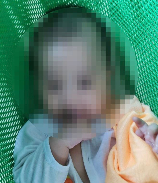  Bé N.Đ.H.A vẫn đang nguy kịch sau ca phẫu thuật. Ảnh: NNCC