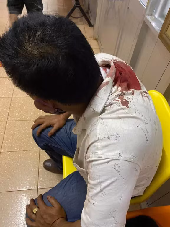 Anh Thanh bị thương ở lưng.