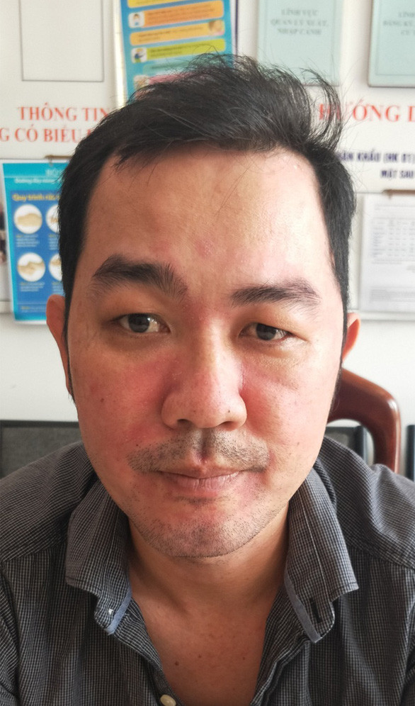  Nghi phạm Nguyễn Châu Tuấn - Ảnh: THÀNH LONG