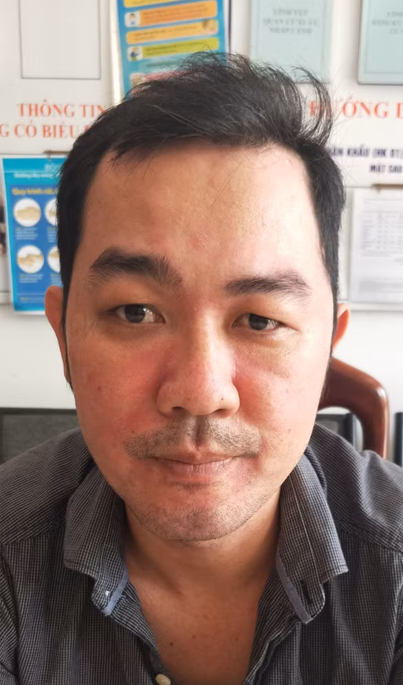  Nghi phạm Nguyễn Châu Tuấn - Ảnh: THÀNH LONG