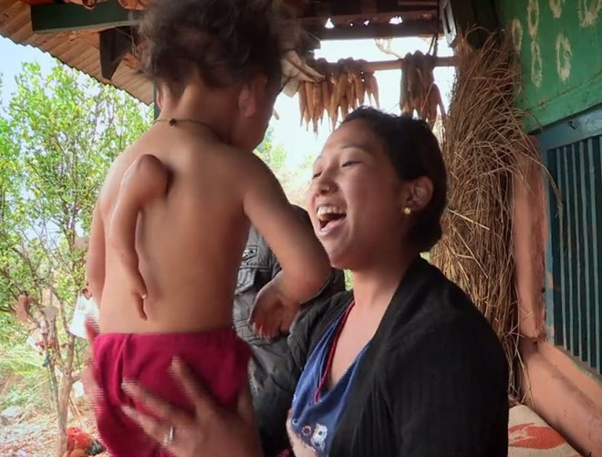 Cậu bé Gaurab Garum, 2 tuổi, ở Nepal có ba cánh tay  Cậu bé Gaurab Garum, 2 tuổi, ở Nepal có ba cánh tay
