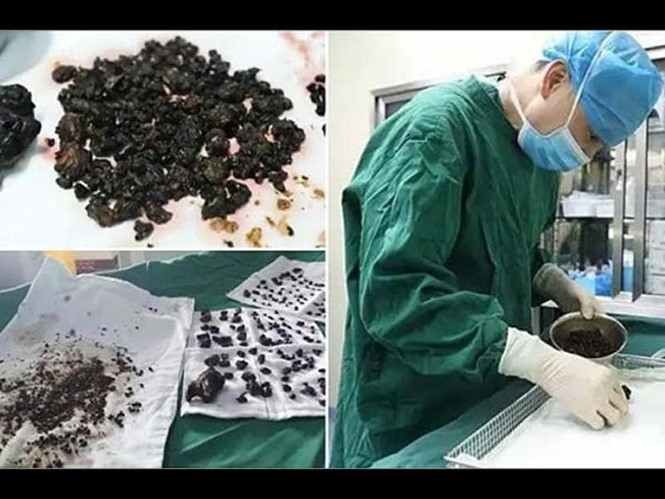 Ảnh chụp màn hình boldsky