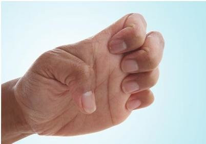 Bài tập móng vuốt. Bài tập móng vuốt.