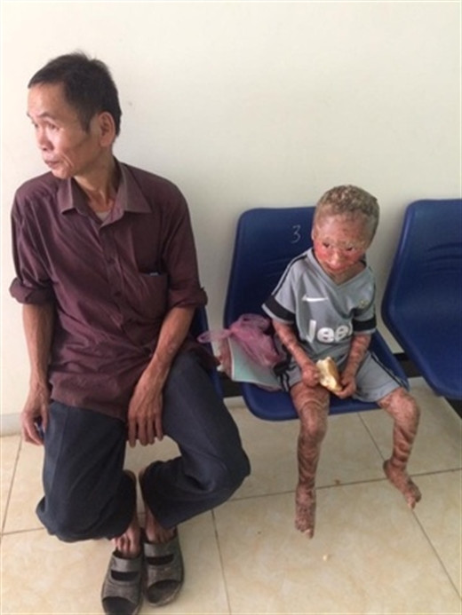 Mẹ bỏ đi, Quân sống trong tình thương của ông nội