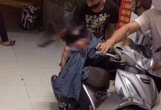 Hình ảnh nam thanh niên bị dao cắm vào đầu sau khi bị truy sát