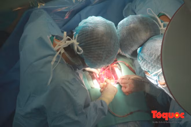 Các bác sĩ thực hiện ca ghép tim. Các bác sĩ thực hiện ca ghép tim.