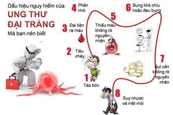 Dấu hiệu ung thư đại trực tràng. Ảnh: Báo Sài Gòn Giải Phóng Online Dấu hiệu ung thư đại trực tràng. Ảnh: Báo Sài Gòn Giải Phóng Online