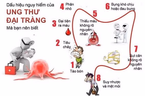 Dấu hiệu ung thư đại trực tràng. Ảnh: Báo Sài Gòn Giải Phóng Online