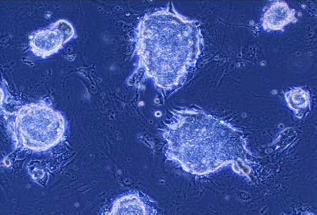 Tế bào iPS. Nguồn: Asia Nikkei