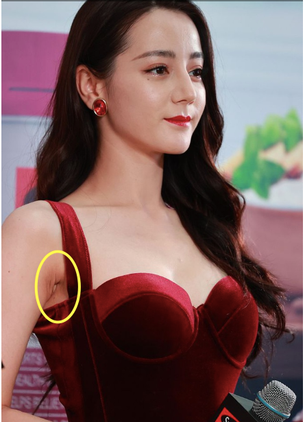 Sở hữu sắc vóc đẹp tựa nữ thần nhưng Địch Lệ Nhiệt Ba vẫn không giấu được làn da vùng nách xỉn màu, nhăn nheo.