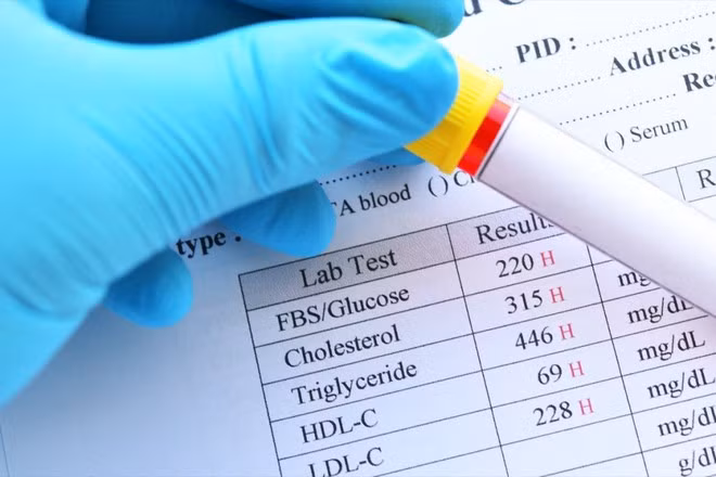 Theo dõi mức đường huyết - Ảnh: Shutterstock