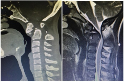 Hình ảnh chụp CT trước khi mổ. Ảnh: BVCC Hình ảnh chụp CT trước khi mổ. Ảnh: BVCC
