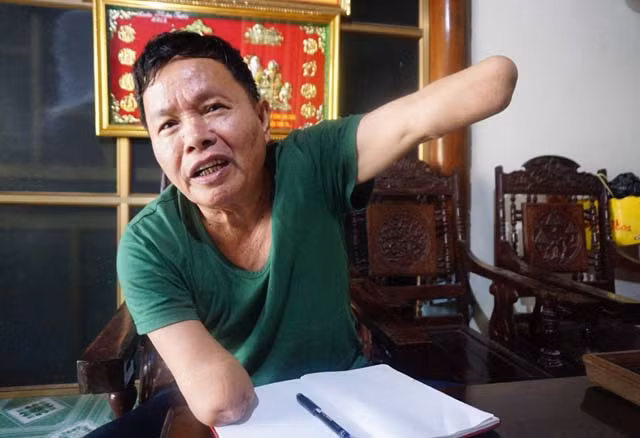 Cựu lính pháo binh Nguyễn Văn Linh và đôi bàn tay cụt đến khuỷu