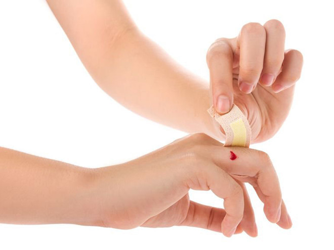 Nếu bạn có bất kỳ vết cắt hoặc trầy xước ở bất kỳ phần nào của cơ thể, hãy áp dụng sơ cứu. Nếu nó không hiệu quả, hãy tham khảo ý kiến bác sĩ ẢNH MINH HỌA: SHUTTERSTOCK