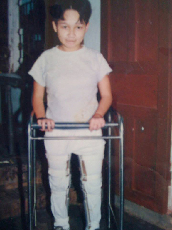 Trà My mắc bệnh và bị khuyết tật nặng từ bé - Ảnh: NVCC