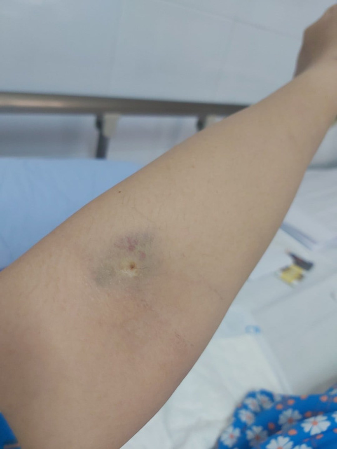 Chị T. bức xúc đưa hình ảnh bị ảnh hưởng khi điều trị lên mạng cá nhân