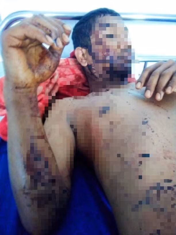 Anh Y Trang Niê bị trúng đạn ở tay. Ảnh Facebook