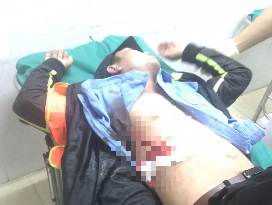 Nhân viên Trạm thu phí BOT Ninh Xuân bị đâm