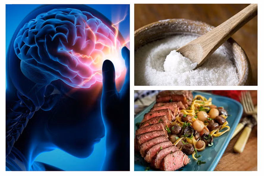 Chú ý đến chế độ ăn uống hằng ngày là cách tốt nhất để ngăn ngừa đột quỵ xảy ra. Ảnh đồ họa: P.Công