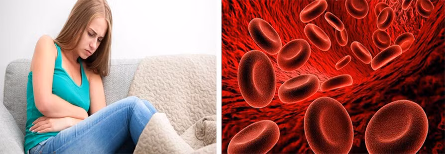 Ra máu quá nhiều trong kỳ kinh nguyệt có thể là dấu hiệu u xơ tử cung. Đồ họa: Hồng Nhật