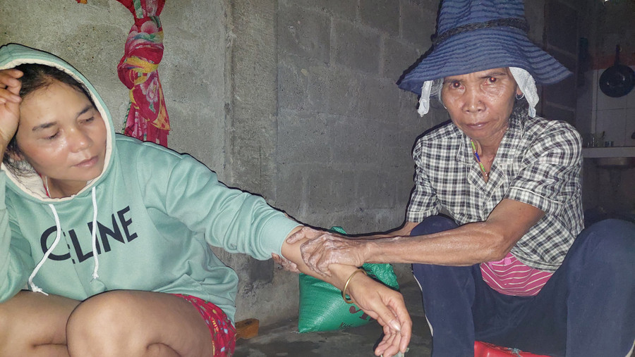 Mế Căn Ni dùng bài thuốc thổi để chữa các bệnh về xương khớp. Ảnh: Hoàng Sơn