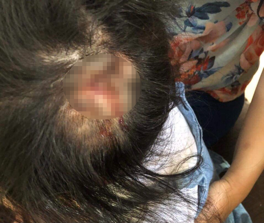 Bé gái 4 tuổi bị dì ruột đánh đập vì biếng ăn. Ảnh: Tân Kỳ Bé gái 4 tuổi bị dì ruột đánh đập vì biếng ăn. Ảnh: Tân Kỳ