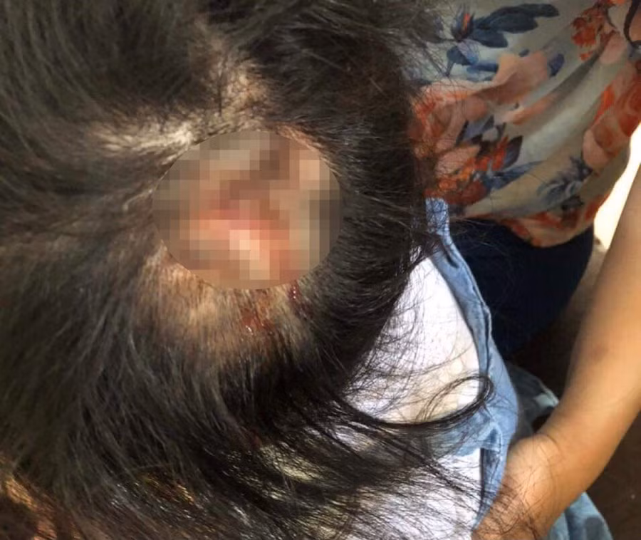 Bé gái 4 tuổi bị dì ruột đánh đập vì biếng ăn. Ảnh: Tân Kỳ