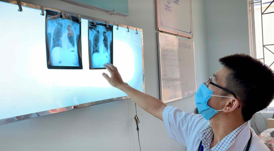 Năm 2021, do ảnh hưởng của dịch Covid-19, không triển khai khám phát hiện chủ động nên Gia Lai chỉ phát hiện 500 bệnh nhân lao các thể, đạt 66,1% so với kế hoạch đề ra. Ảnh: Như Nguyện