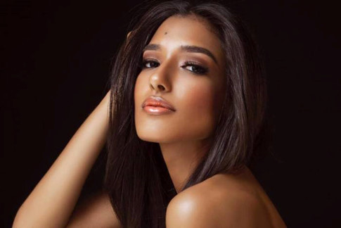  Dayanara Martínez từng được khuyên xóa nốt ruồi trên trán nhưng cô từ chối đụng vào 