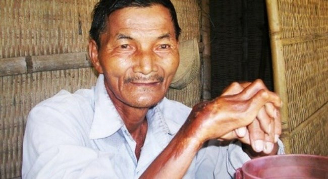 Tuy không ngủ trong suốt 45 năm nhưng ông Ngọc vẫn rất minh mẫn và khỏe mạnh.