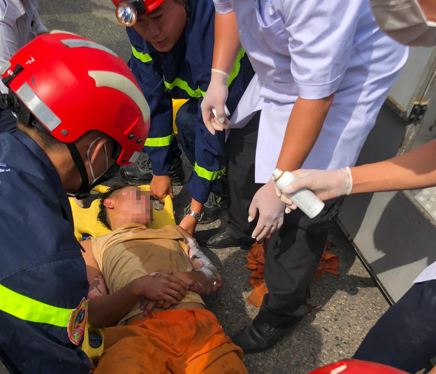  Nam thợ điện 20 tuổi bị bỏng nặng ở tay, mặt được Cảnh sát PCCC và cứu nạn cứu hộ giải cứu, đưa đi cấp cứu. Ảnh: HĐ