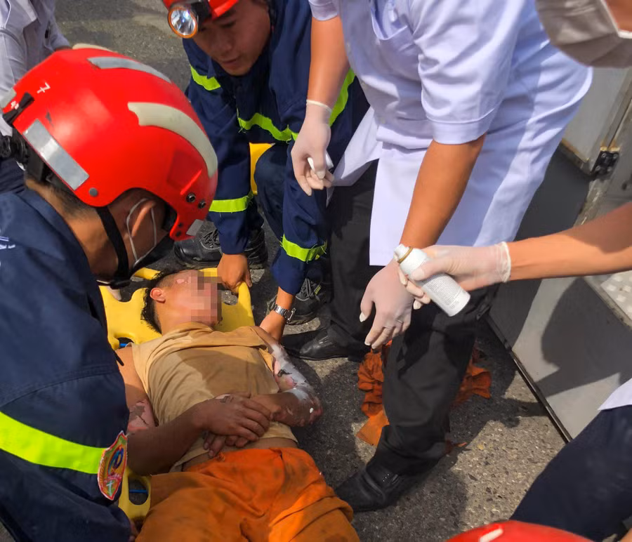  Nam thợ điện 20 tuổi bị bỏng nặng ở tay, mặt được Cảnh sát PCCC và cứu nạn cứu hộ giải cứu, đưa đi cấp cứu. Ảnh: HĐ