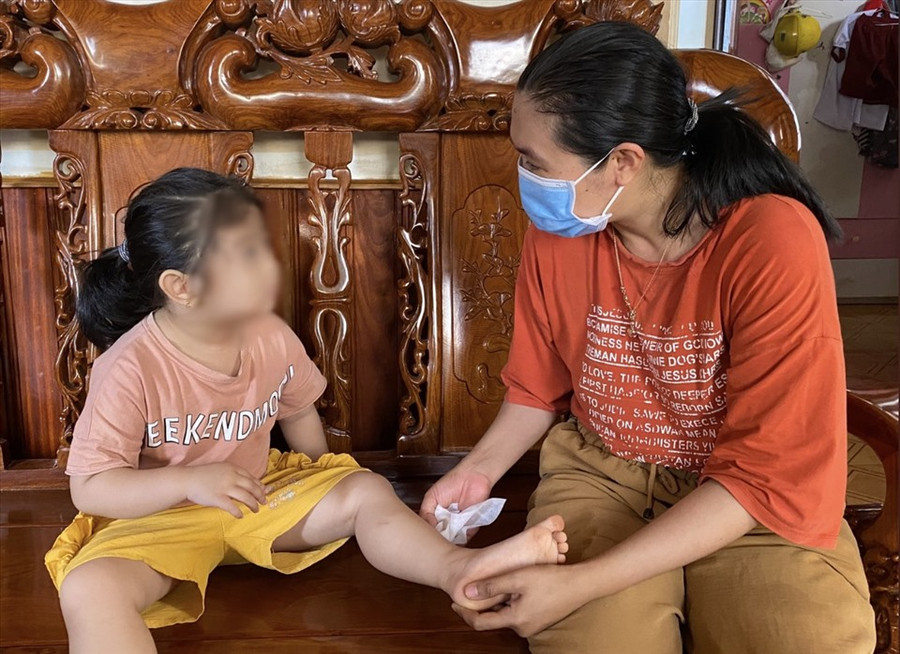 Từ đầu năm đến nay, trên địa bàn huyện Cư M'gar đã có 10 trường hợp bị bệnh dại vì bị chó, mèo, vật nuôi cắn vào người. Ảnh: T.D Từ đầu năm đến nay, trên địa bàn huyện Cư M'gar đã có 10 trường hợp bị bệnh dại vì bị chó, mèo, vật nuôi cắn vào người. Ảnh: T.D