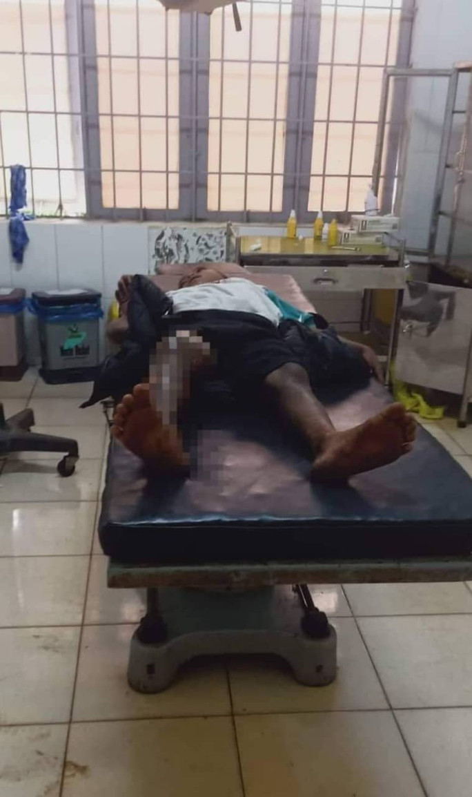 Cháu bé không chịu đi trộm cắp bị tẩm xăng đốt Cháu bé không chịu đi trộm cắp bị tẩm xăng đốt