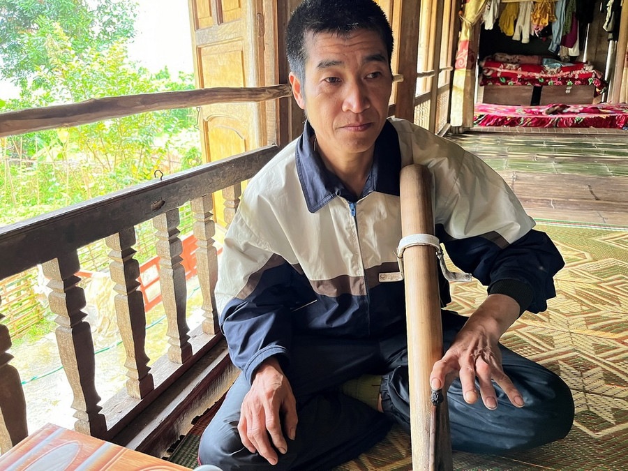 Vết thương ở tay trái cựu chiến binh Hoàng Văn Phát. Ảnh: Mai Thanh Hải