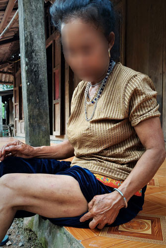 Nước sông Krông Klang ô nhiễm khiến nhiều người dân bị ghẻ lở Ảnh: HẢI PHONG Nước sông Krông Klang ô nhiễm khiến nhiều người dân bị ghẻ lở Ảnh: HẢI PHONG