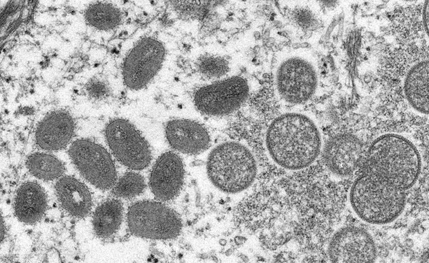  Hình ảnh virus đậu mùa khỉ dưới kính hiển vi điện tử. (Ảnh: AFP/TTXVN)