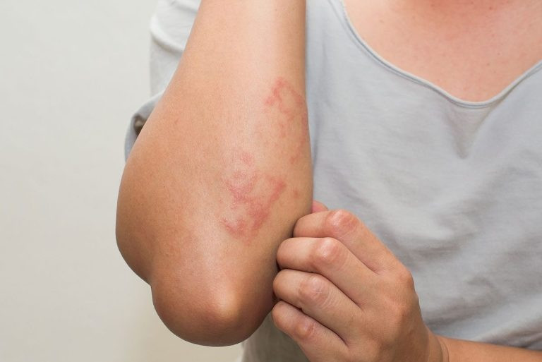Bạn có bị ngứa da không? Ảnh: Shutterstock Bạn có bị ngứa da không? Ảnh: Shutterstock