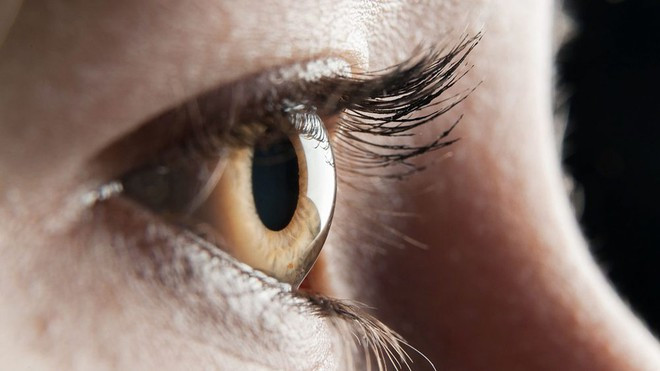 Các nhà nghiên cứu khuyến cáo mọi người nên hạn chế ăn thịt chế biến, thực phẩm chiên, ngũ cốc tinh chế và sữa giàu chất béo để bảo vệ thị lực theo thời gian ẢNH MINH HỌA: SHUTTERSTOCK