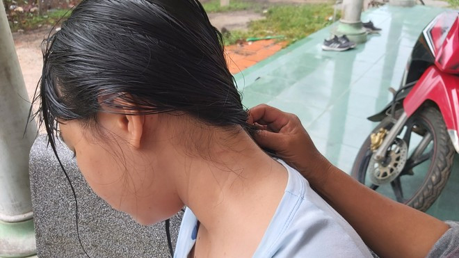 Trên cổ nạn nhân vẫn còn vết thương do bị đánh ẢNH: NGUYỄN LONG