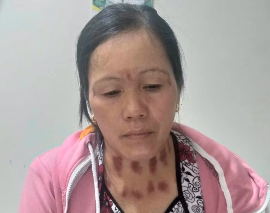 Đối tượng Tốt đã bị bắt giữ. Ảnh: Văn Ngọc