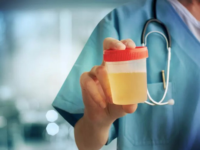 Qua xét nghiệm nước tiểu, ta biết cơ thể tiêu thụ đồ ăn ra sao, cần tuân thủ chế độ ăn cụ thể như thế nào ẢNH MINH HỌA: SHUTTERSTOCK