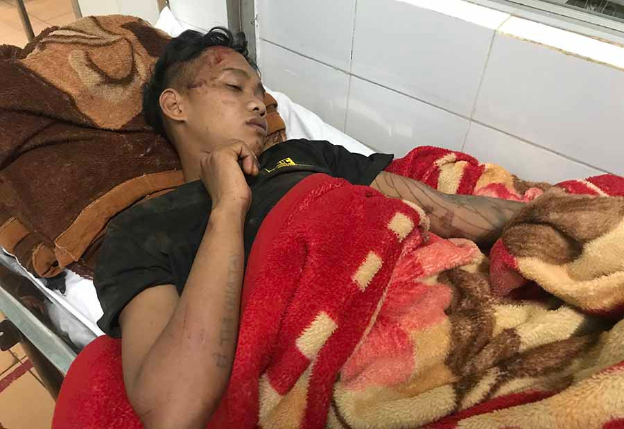  Anh Kpă Pin (xã Thăng Hưng, huyện Chư Prông) đang nằm điều trị tại Bệnh viện Đa khoa tỉnh. Ảnh: L.G