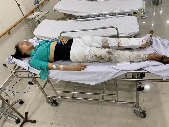  Nữ tiếp viên hàng không được cấp cứu trong tình trạng bị thương nặng (ảnh: Facebook)