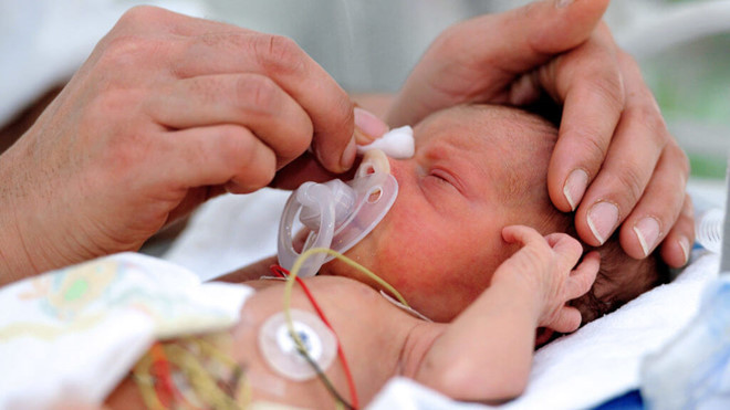 Nhận viên y tế chăm sóc một trẻ sinh non - Ảnh: AFP