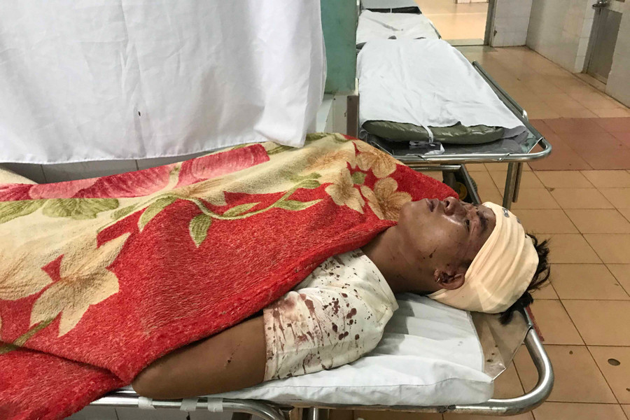 Uin phải nhập viện cấp cứu chỉ vì nhắc người khác không dành micro khi hát karaoke. Ảnh: Lê Văn Ngọc