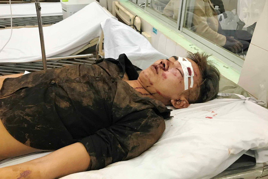  Trình đang được cấp cứu trong tình trạng nguy kịch. Ảnh: Văn Ngọc 