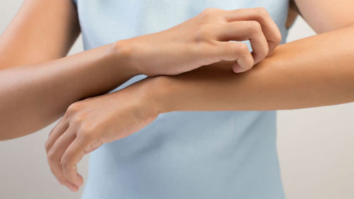 Cần đi khám sớm nếu da khô gây ngứa ngáy khó chịu lâu ngày Cần đi khám sớm nếu da khô gây ngứa ngáy khó chịu lâu ngày