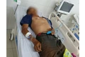 Vụ ngộ độc do ăn bọ xít tại Gia Lai: Bệnh nhân đã tử vong